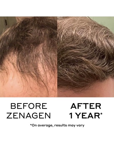 Zenagen - Revolve Men's Shampoo - 200ml @ BarberKing.ca