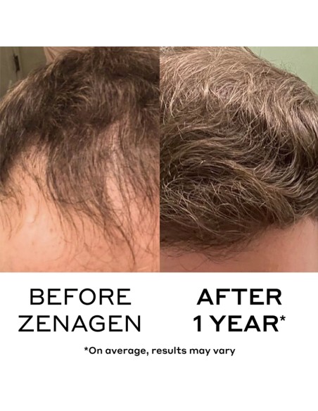 Zenagen - Revolve Men's Shampoo - 200ml @ BarberKing.ca